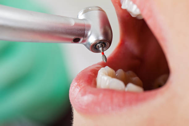 Best Emergency Denture Repair in Burkesville, KY